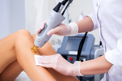 Ditch the Razor, Embrace Smooth: Laser Hair Removal vs. Shaving