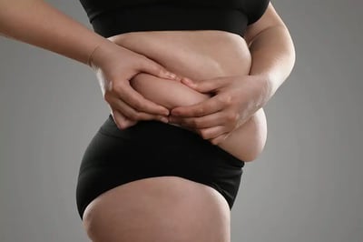 Target & Destroy Fat Cells With CoolSculpting® ELITE